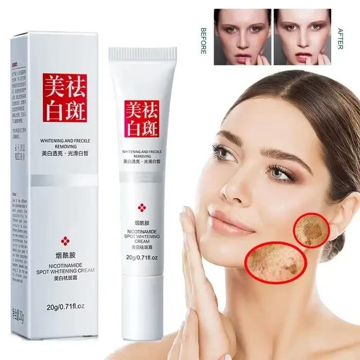 Crème pour le visage, estompe les taches de rousseur, taches foncées, Niacinamide, crème blanchissan