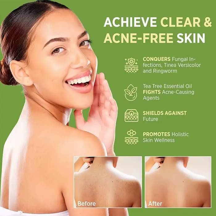 Savon à l'huile d'arbre à thé pour hommes et femmes, extrait de plantes naturelles, savon fait à la main, nettoyage en profondeur, apaisant pour les peaux sèches, exfoliant, soin de la peau