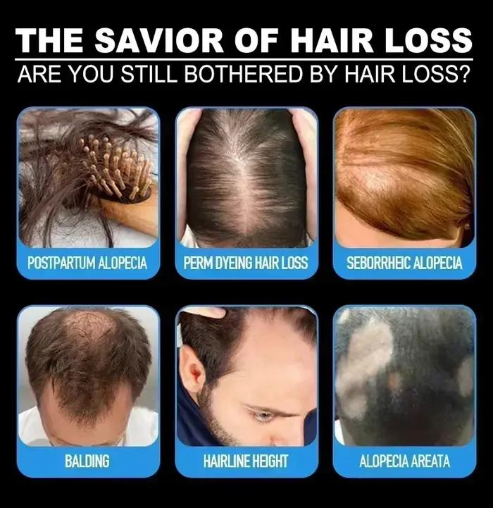 Traitement Essentiel de Repousse et de Croissance des Cheveux