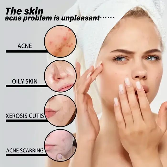 Huiles essentielles à l'essence pour le visage
