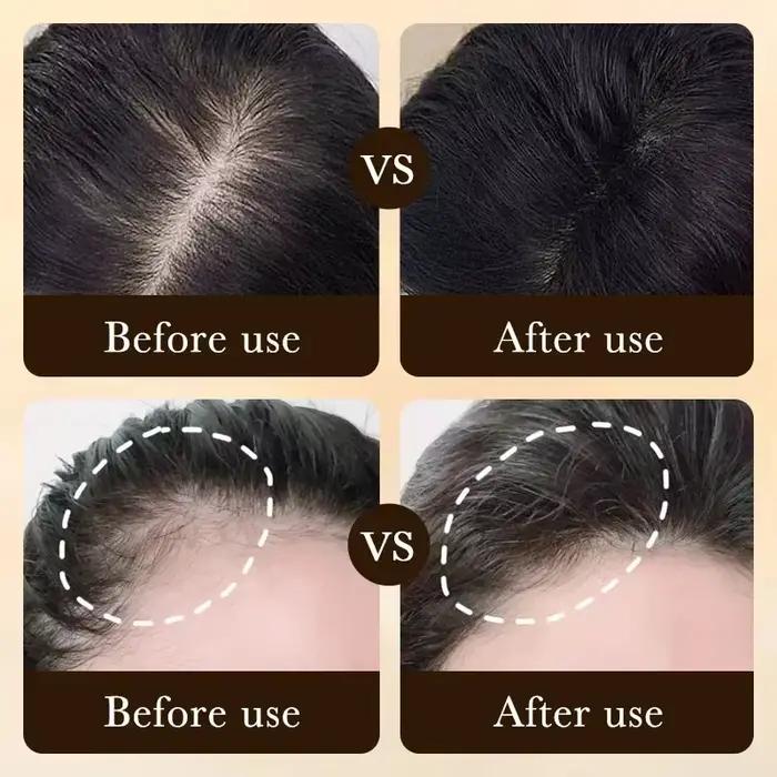 Traitement Essentiel de Repousse et de Croissance des Cheveux