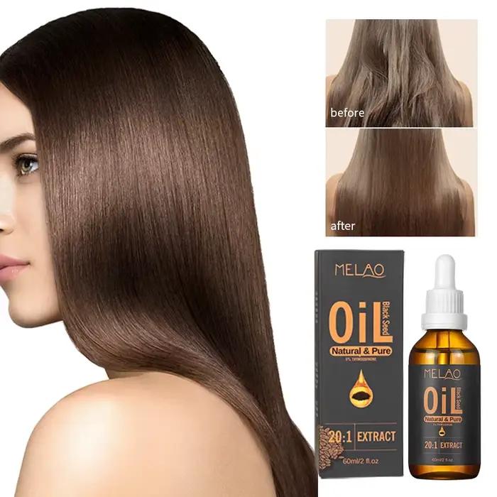 Huile de graines de cumin noir turc