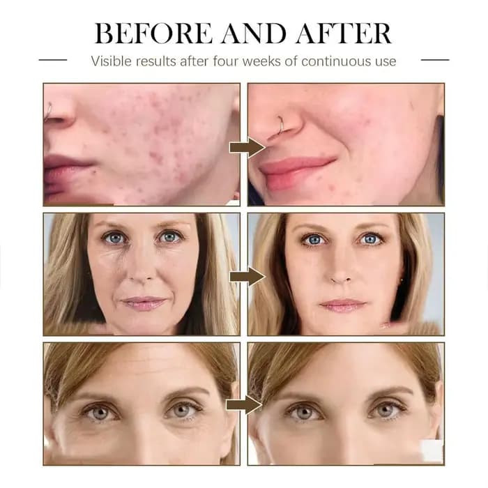 1/2/3 pièces huile de ricin à l'huile de rose musquée huile de graines noires huile de rose musquée sérum pour le visage, hydratant pour le visage huile naturelle pour le visage huile de graines de ro