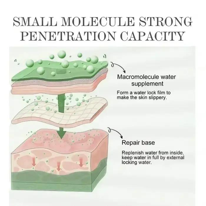 3ème crème Anti-acné efficace élimine les Nodules de la peau Pustules Cysts Papules points noirs hommes et femmes acné