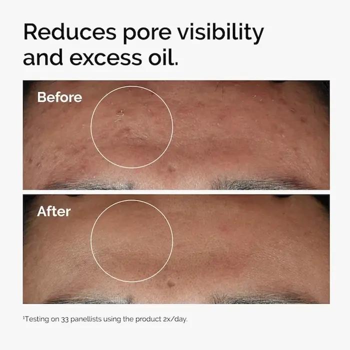 Niacinamide coréenne 10% + Zinc 1% sérum 30ml multi-effet améliorer la Texture réduire l'excès d'huile renforcer la barrière contre l'humidité de la peau