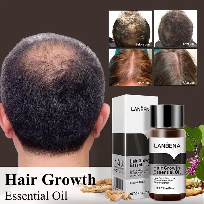 LANBENA huile essentielle nourrissante pour cheveux traitement Anti-perte