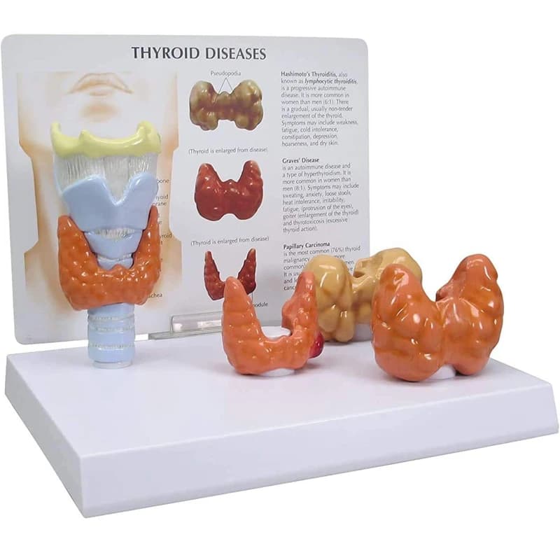 Modèle de thyroïde anatomique humain, pathologie, anatomie, système digestif, affichage, outil d'ens