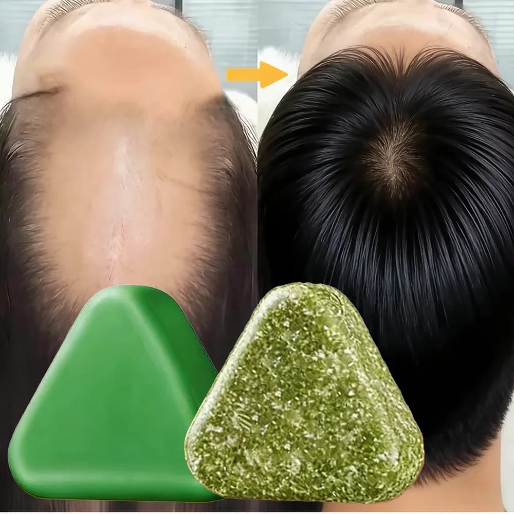 Shampoing à base de plantes naturelles, savon fait à la main, nourrissant, contrôle de l'huile, soin