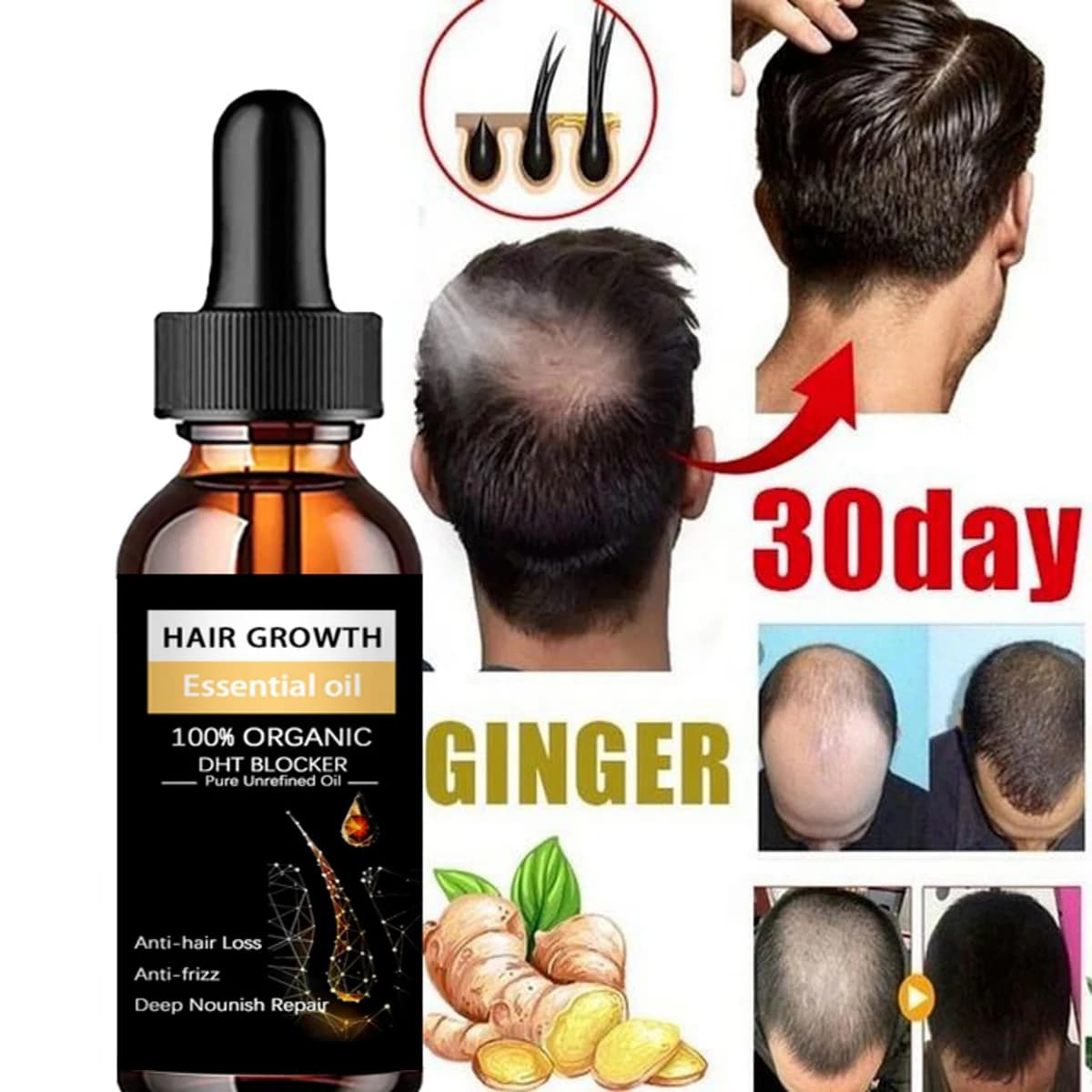 Spray capillaire GROWER, produit Anti-chute de cheveux, huile essentielle, sérum de croissance pour 