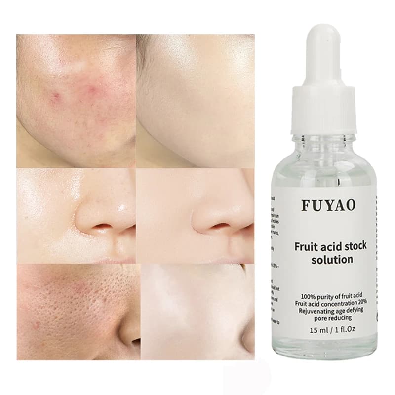 Huile liquide anti-déformable à l'acide glycolique, crème pour le visage, blanchissant, soins de la peau, sérum anti-âge, 20%