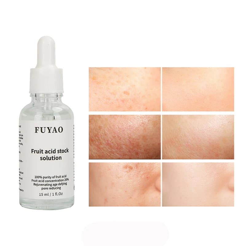Huile liquide anti-déformable à l'acide glycolique, crème pour le visage, blanchissant, soins de la peau, sérum anti-âge, 20%