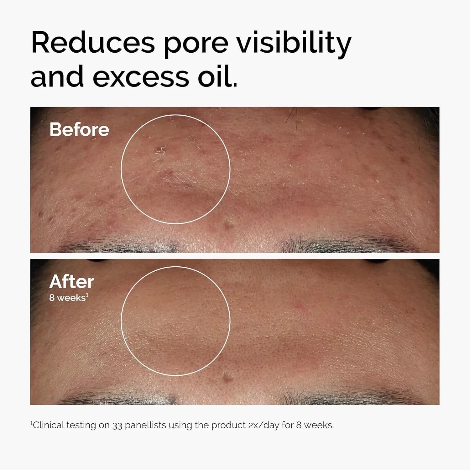 Sérum pour le visage à 10% de niacinamide et 1% de zinc