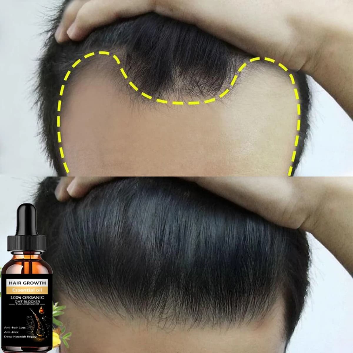Spray capillaire GROWER, produit Anti-chute de cheveux, huile essentielle, sérum de croissance pour hommes