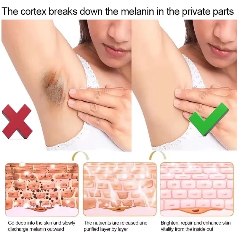 Crème Éclaircissante Corporelle pour Zones Intimes, Bras, Genoux, Lèvres et Peaux Foncées – Éclaircissement de la Mélanine, Essence Rose Hydratante et Soin Intime