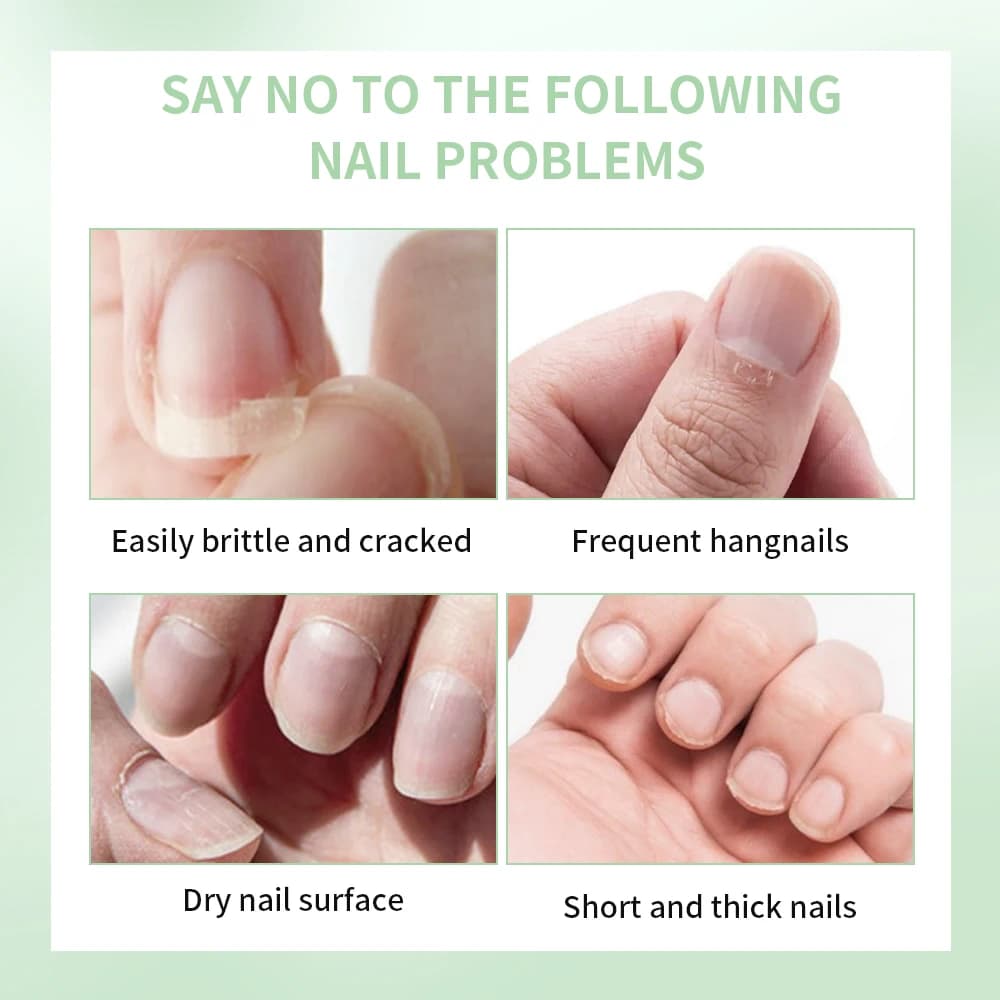 Huile de renforcement pour la croissance des ongles, 5ml, huile saine et forte pour la croissance des ongles, aide à fendre les ongles fins, réparation de manucure, huile pour cuticules