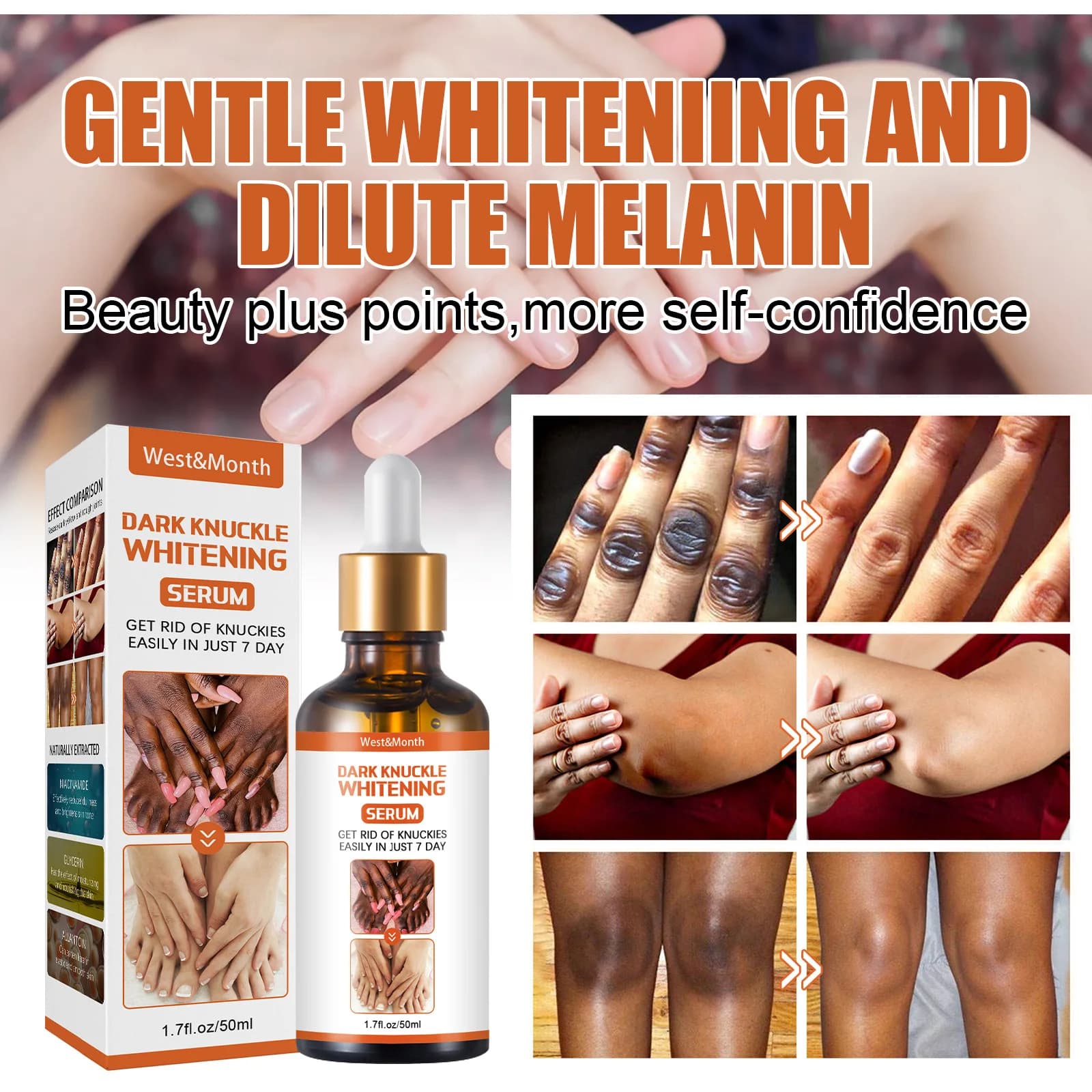 Sérum éclaircissant pour les articulations foncées, 50ml, pour les mains, les coudes, les genoux, huile éclaircissante, dissolvant de taches intenses, produits de soins de beauté