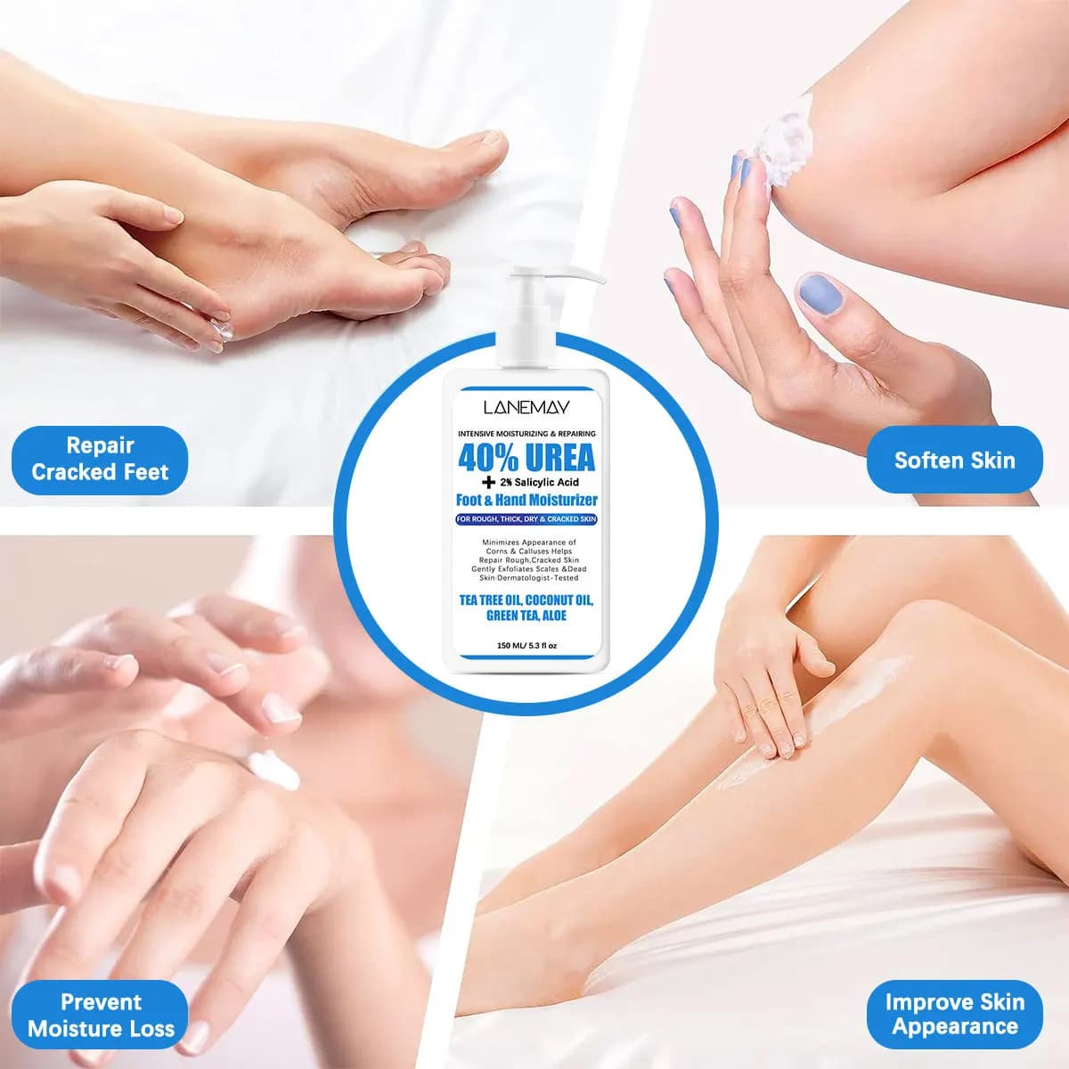 Crème pour les mains à l'urée et à l'acide salicylique, contenant de l'huile d'arbre à thé, de l'urée, d'acide salicylique et d'aloe vera, hydrate les mains et les pieds