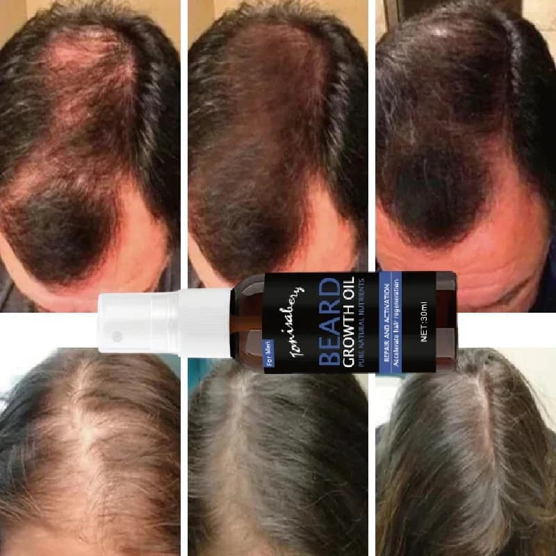 Sérum de croissance de barbe Spray, huile essentielle de croissance de cheveux, plus épais, plus épais, plus complet, adoucissant, liquide hydratant pour barbe