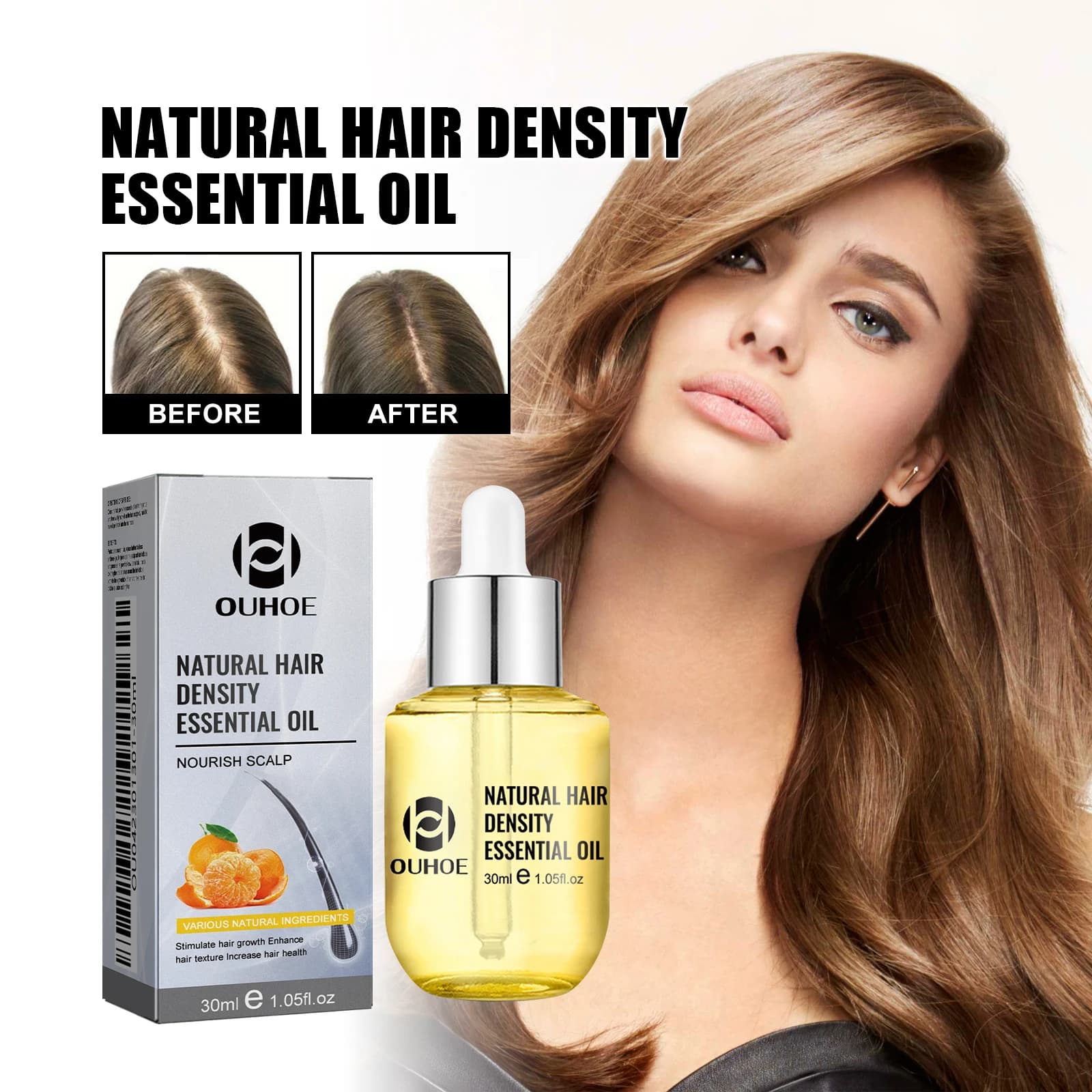 Ouhoe – huile de soin capillaire pour amincir les cheveux, sérum de traitement du cuir chevelu pour renforcer les racines et réparer les cheveux endommagés, formule naturelle 30ml