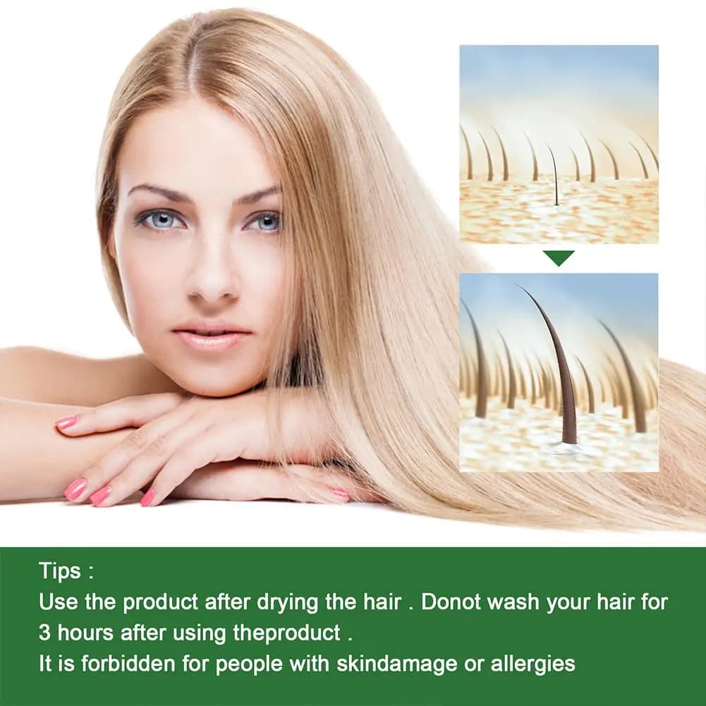 Huile de romarin pour la croissance des cheveux, huile essentielle de noix de coco, améliore la perte de cheveux et nourrit, renforce les racines des cheveux, traitement du cuir chevelu, soins capilla
