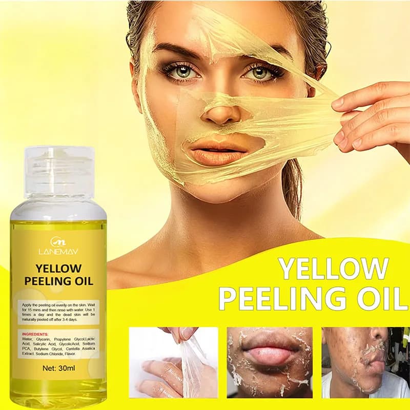 Lotion éclaircissante forte à l'huile de peeling jaune pour peaux foncées
