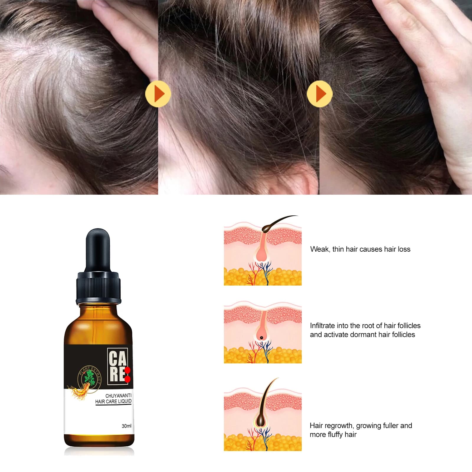 Huile essentielle pour le soin du cuir chevelu Polygonum Multiflorum, huile capillaire hydratante, non grasse, absorption rapide, traitement capillaire réparateur, nourrissant