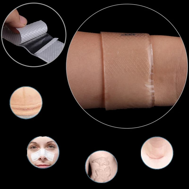 1PC Patch en silicone réutilisable pour la réparation cutanée, traitement des cicatrices, des traumatismes, des brûlures et de l'acné, Nouveau