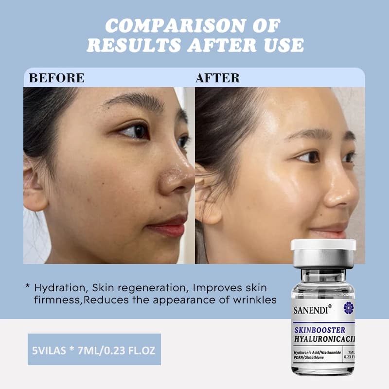 Sanendi peau BOOSTER acide hyaluronique Solution de problèmes de peau du visage hydratant hydratation Solution de protéines de soin de la peau coréenne