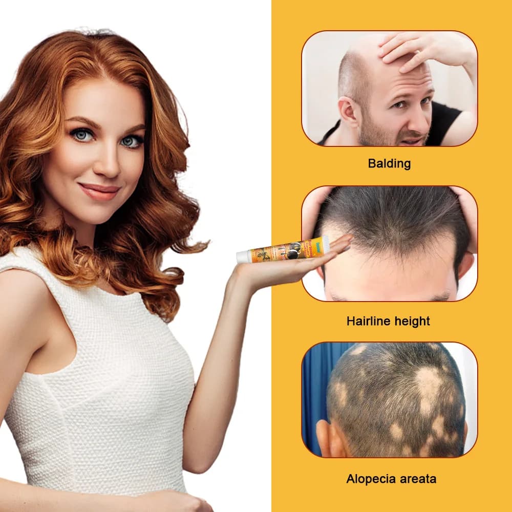 Crème sérum pour la croissance des cheveux, Capsule essentielle pour une repousse rapide, Anti-chute de cheveux, Traitement de la calvitie, Réduit les dommages du cuir chevelu, Pour femmes et hommes