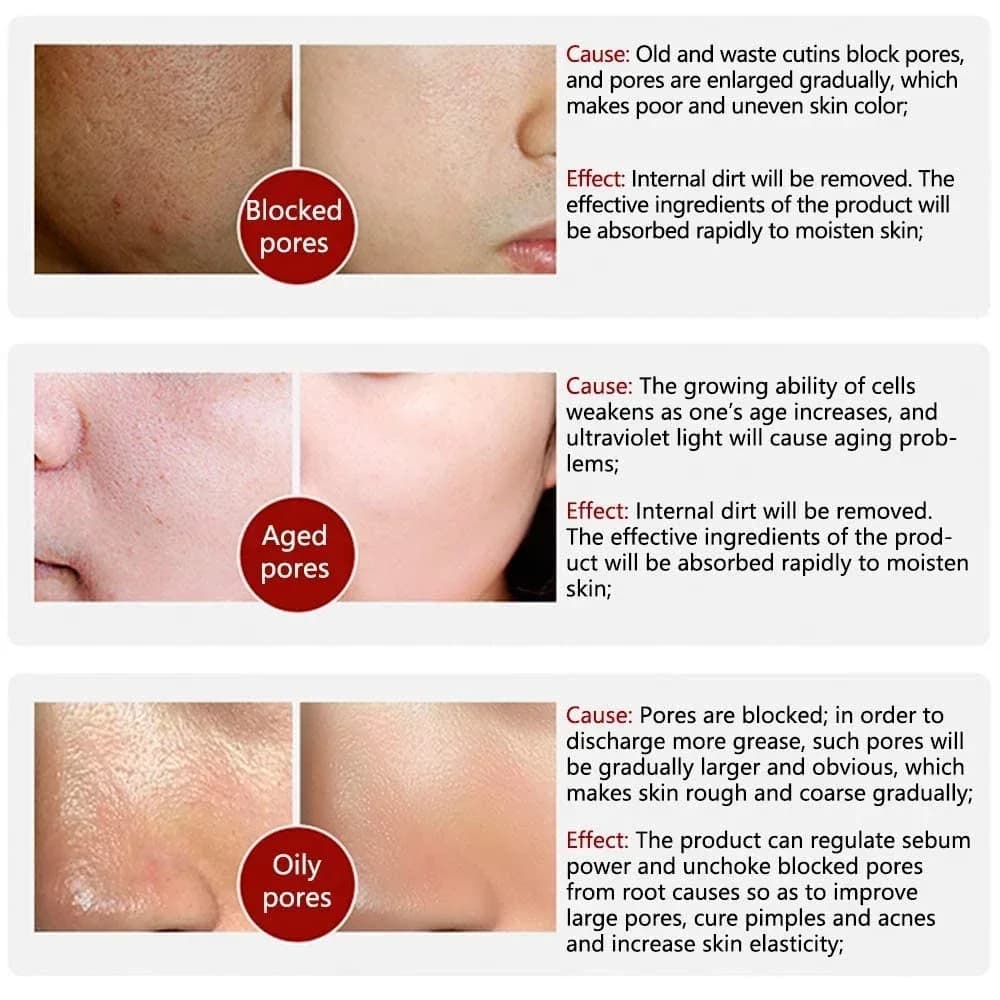 Skin Bergamo | Pore Refining Resurfacing, Sérum visage éclaircissant au rétinol et à la niacinamide non comédogène