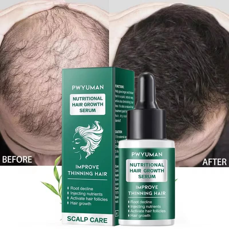 Sérum de croissance rapide des cheveux pour femmes et hommes, prévention de la perte de cheveux, repousse des cheveux, huile essentielle, réparation des racines des cheveux endommagés, soins capillair
