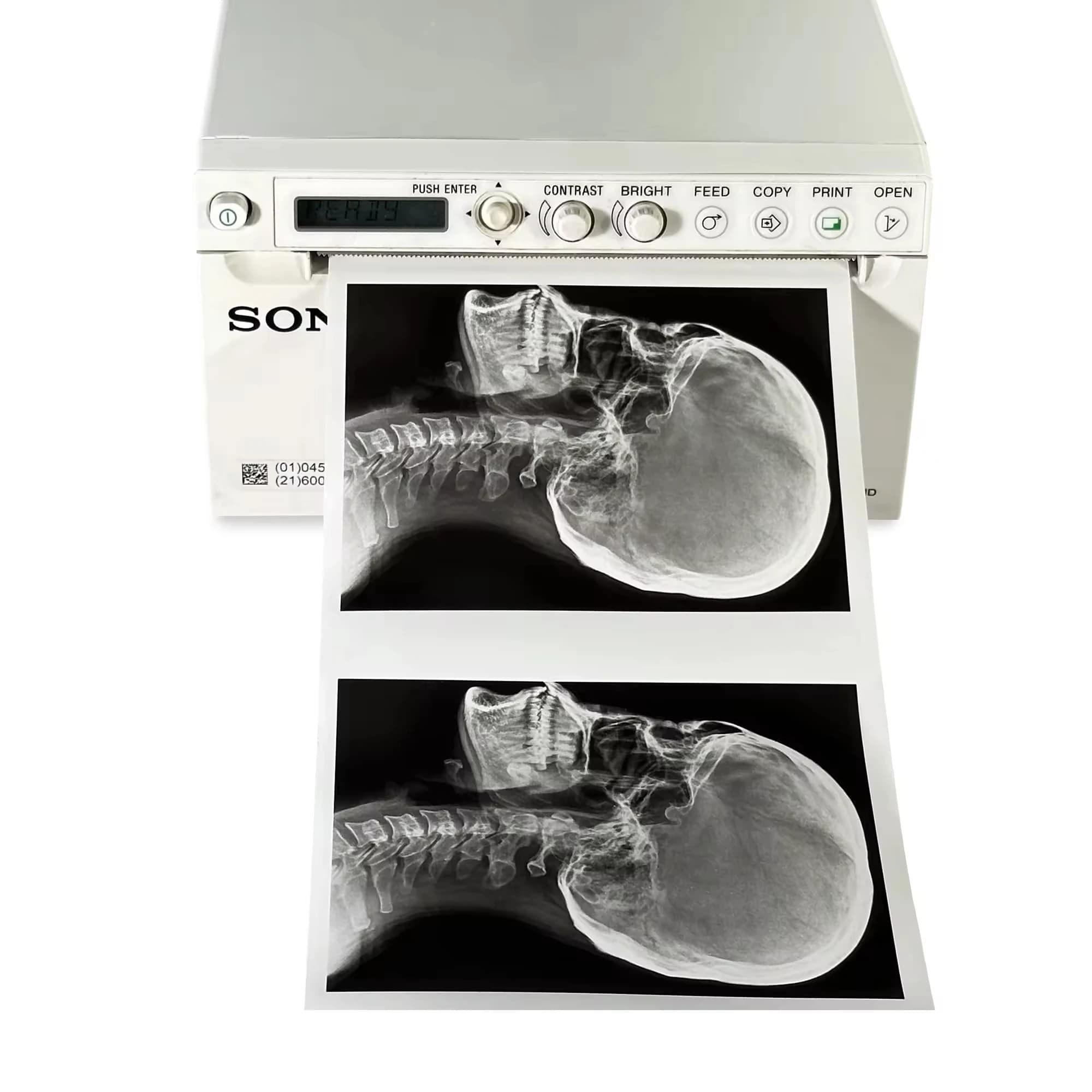 Support d'impression haute densité noir et blanc UPP-110HD A6 (type II) pour imprimantes des séries UP-899/898/897