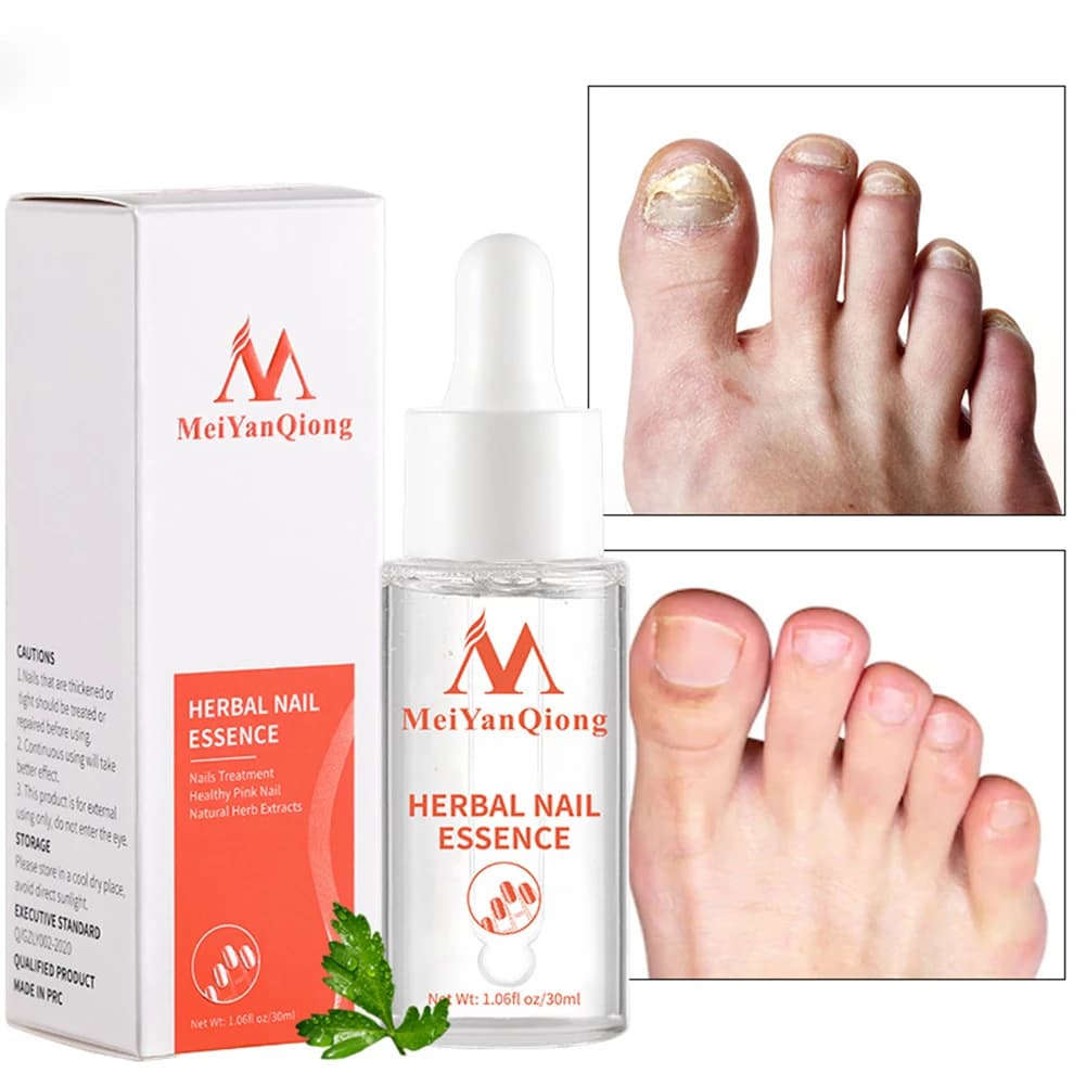 Essence réparatrice d'ongles à base de plantes 30 ml