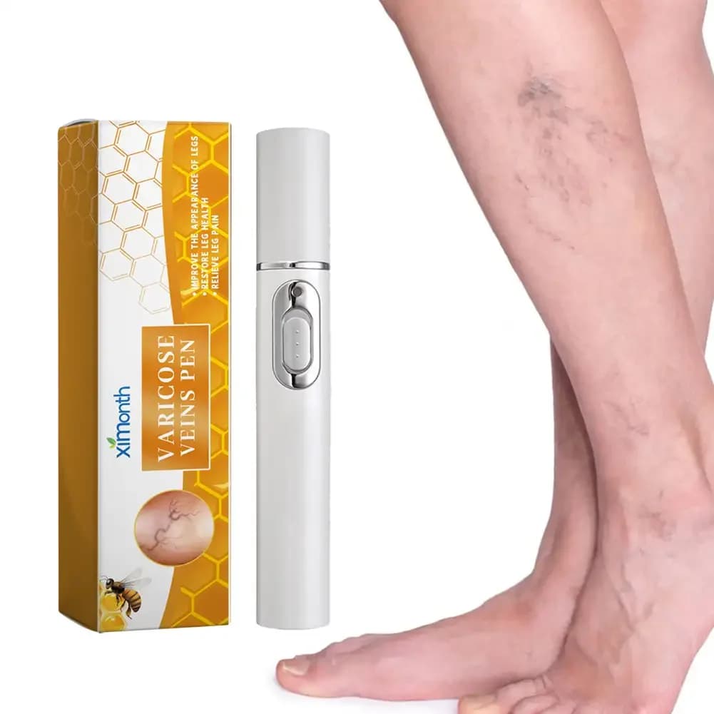 Abat-jour thérapie varices soulagement efficace de la vascularite dilatée dans les jambes phlébite améliorer la Circulation sanguine santé