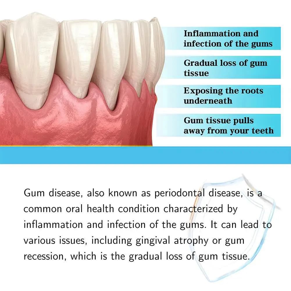 Gouttes pour les gencives Gum Restore Plus, soulagement des gencives, favorise la santé naturelle des tissus gingivaux, renforce l'adhérence, réduit l'inflammation et l'inconfort