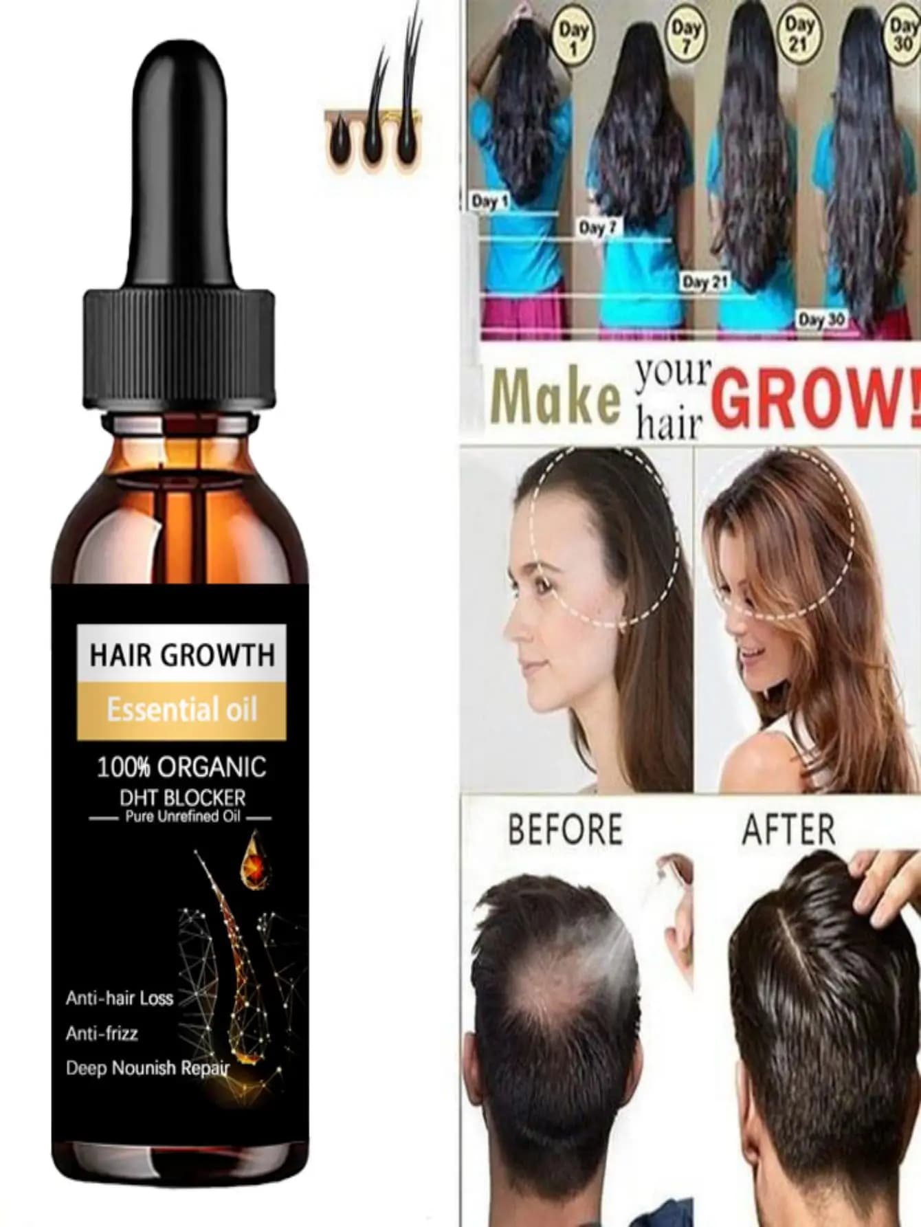 Spray capillaire GROWER, produit Anti-chute de cheveux, huile essentielle, sérum de croissance pour hommes