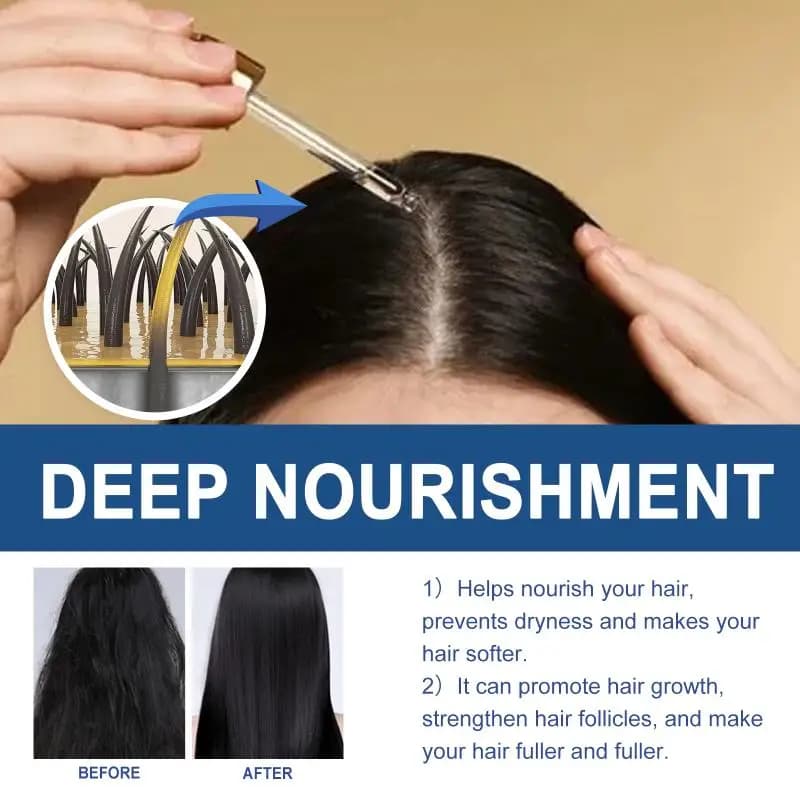 Huile Essentielle Capillaire Nourrissante Hoegoa : Répare les Pointes Sèches et Frisées, Hydrate et Lisse les Cheveux