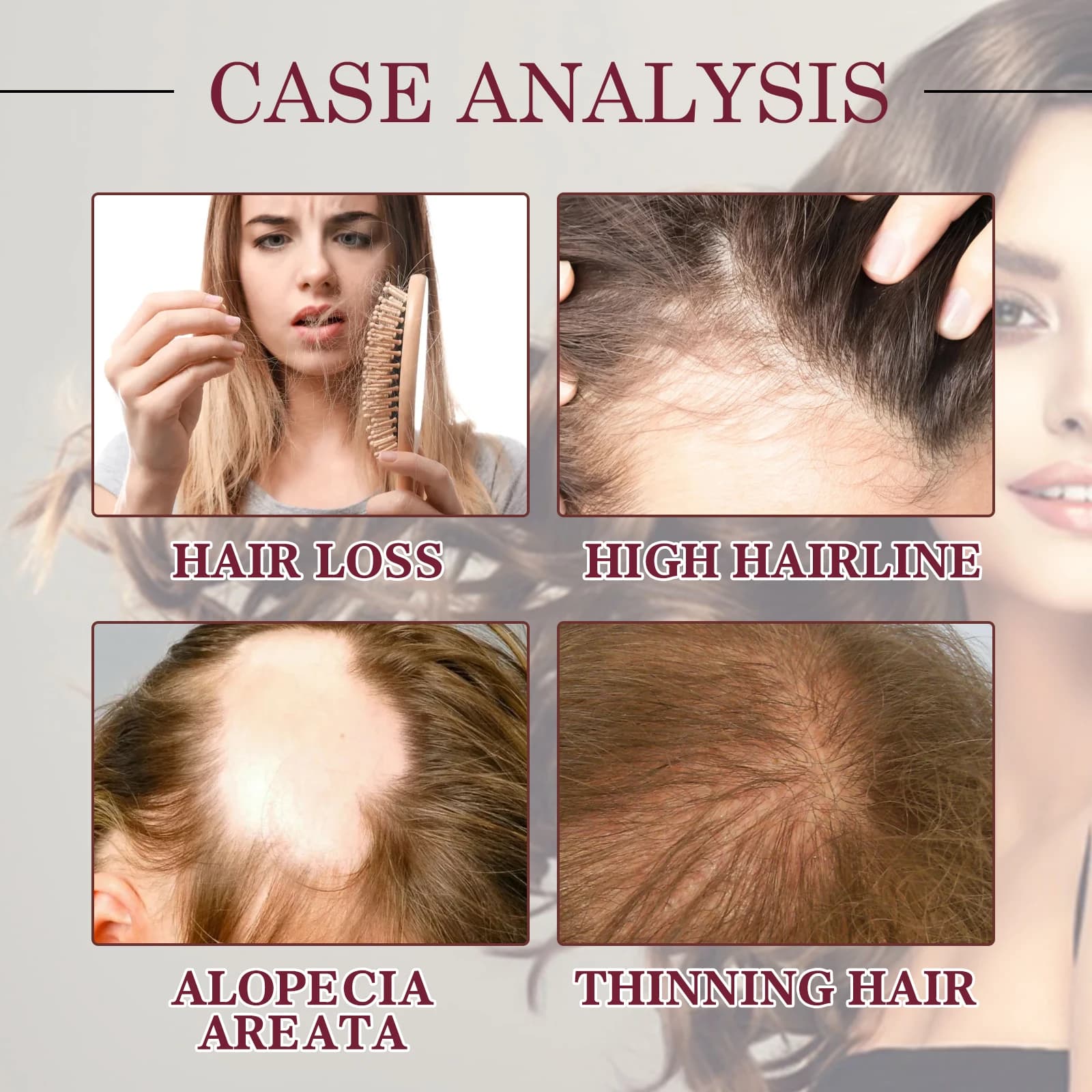 Huile essentielle pour la croissance des cheveux à l'oignon rouge, spray pour soins capillaires, prévient la perte de cheveux, nourrit les racines des cheveux, améliore la texture des cheveux, produit