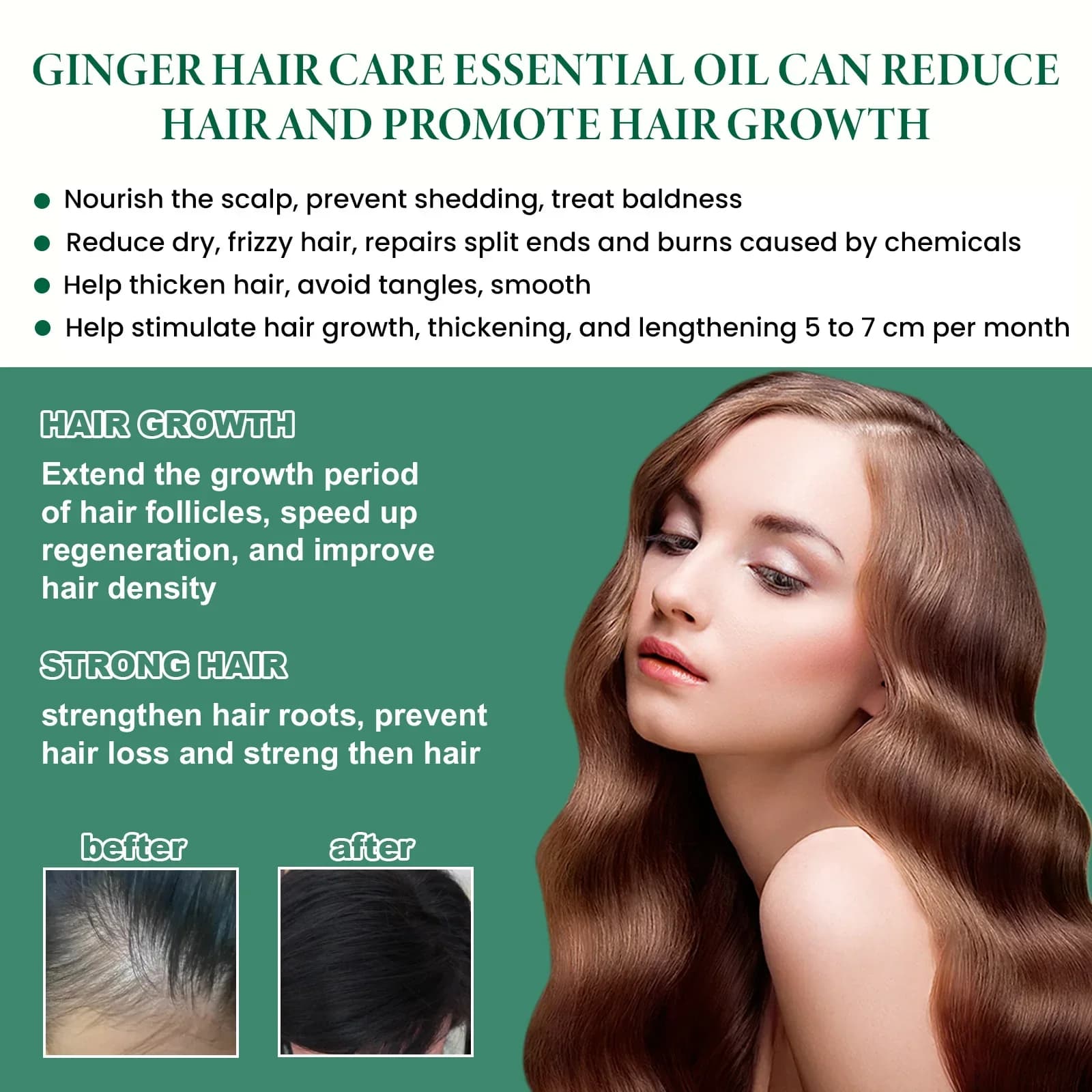 Fluide anti-chute de cheveux au gingembre 30ml - Combat la calvitie, stimule les follicules et nourrit le cuir chevelu, solution de soin capillaire intensive.