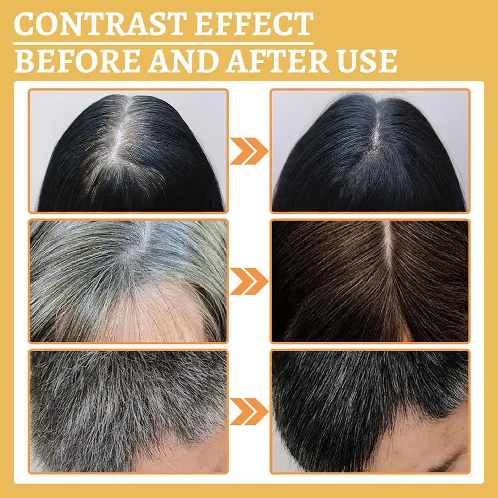 Sérum anti-cheveux gris au Ganoderma - Huile naturelle pour assombrir les cheveux, traitement nourrissant du cuir chevelu pour restaurer la couleur noire des cheveux et réduire les cheveux gris