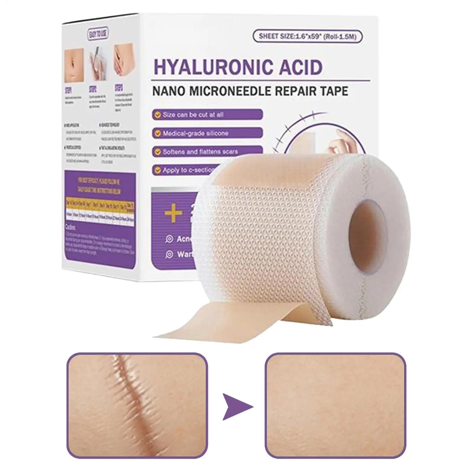 Feuille de cicatrice en Gel de Silicone souple chirurgical, Patch de traitement, bande d'élimination de l'acné, traumatisme, brûlure, couverture de cicatrice, Section de réparation de la peau, beauté 