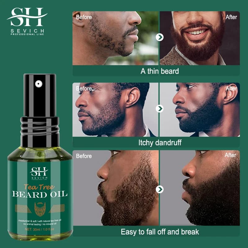 SEVICH huile de barbe de croissance pour hommes soin de garniture de style hydratant plus épais favoriser la repousse de la barbe renforcer la brillance adoucir l'huile de barbe