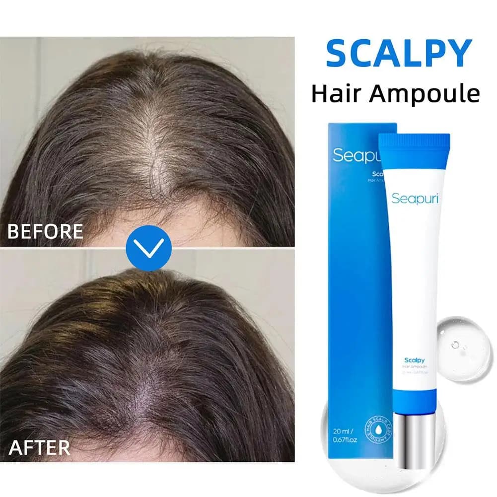Seapuri Scalphy Hair Essence Rollerball, rafraîchissant et rafraîchissant, renforce les racines des cheveux, huile de traitement de calvitie amincissante, soins capillaires