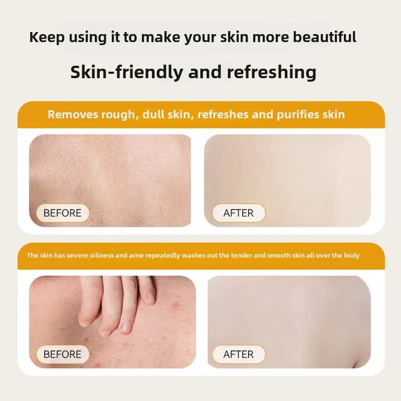 Savon liquide au soufre japonais 300ml, Gel de bain pour éliminer les acariens, nettoyage en profondeur, Gel douche, nettoyage du corps, soins de santé