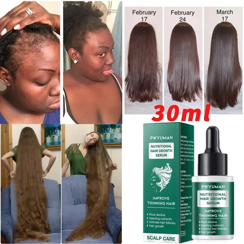 Sérum de croissance rapide des cheveux pour femmes et hommes, prévention de la perte de cheveux, repousse des cheveux, huile essentielle, réparation des racines des cheveux endommagés, soins capillair