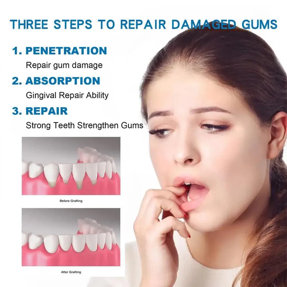 Gouttes pour les gencives Gum Restore Plus, soulagement des gencives, favorise la santé naturelle des tissus gingivaux, renforce l'adhérence, réduit l'inflammation et l'inconfort