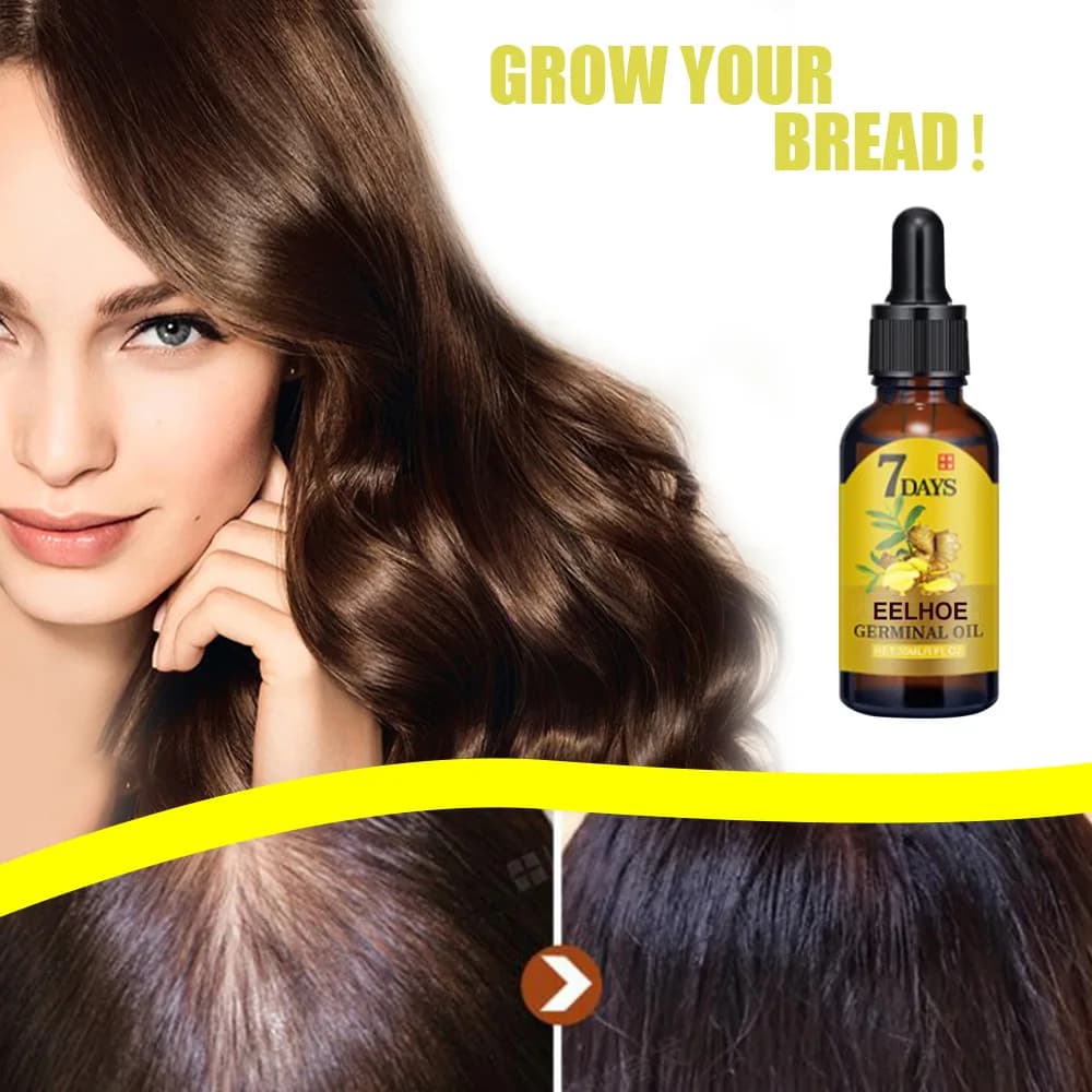EELHOE – huile de croissance des cheveux au gingembre, Essentail naturel, traitement Anti-perte de cheveux, Solution nutritive hydratante pour la croissance des cheveux, produits de soins
