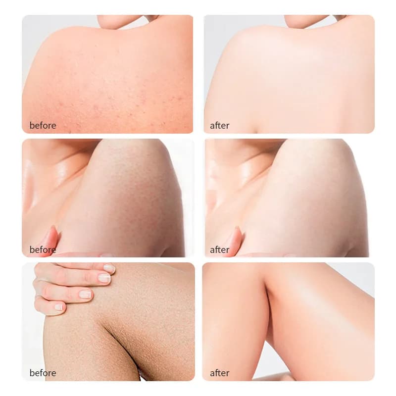 Huile de ricin PMurcia 100% pure et naturelle