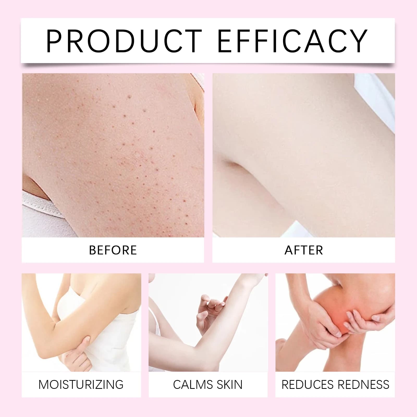 Soins d'épilation huile essentielle soin en douceur pour la peau nettoie l'épilation hydrate et hydrate soin quotidien huile essentielle