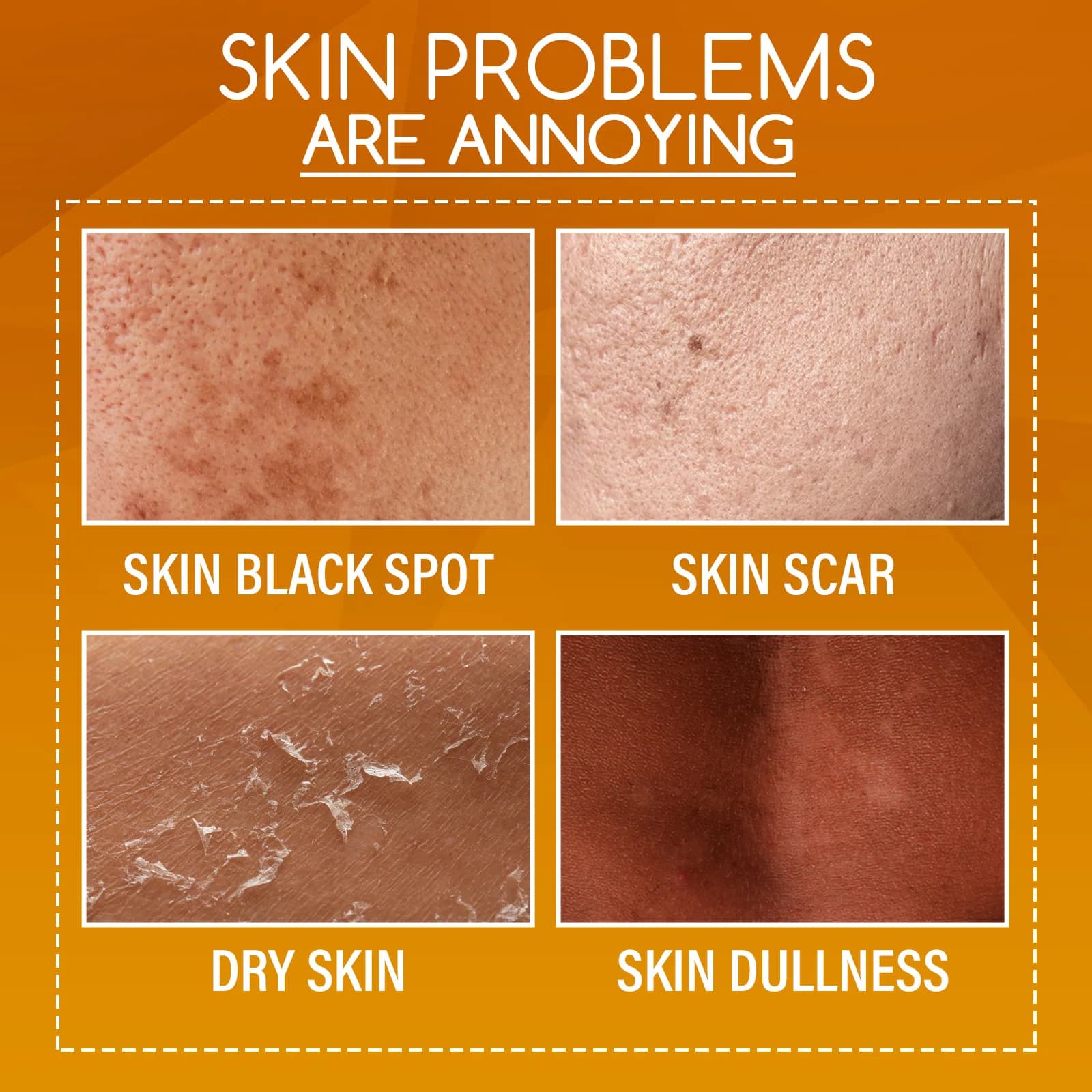 Lotion exfoliante à l'orange pour peaux foncées, éclaircissante, élimine les peaux mortes, nettoyante, hydratante, illuminatrice, huile exfoliante puissante